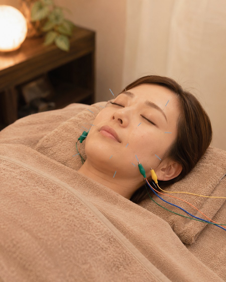 電気かお鍼の施術イメージ